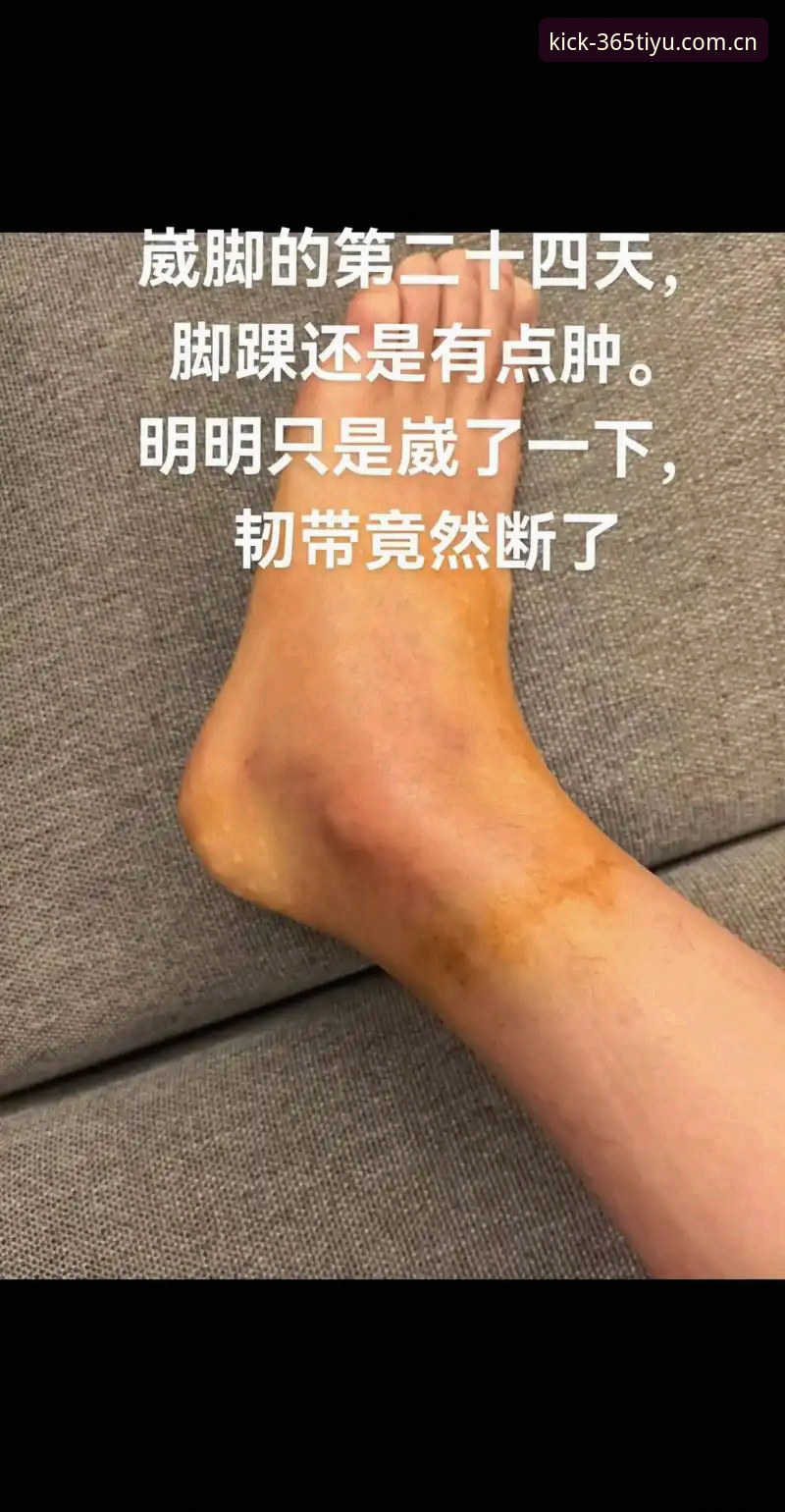 体育足球官网首页安卓版 施洛特贝克世界杯之旅提前终结,左脚踝韧带撕裂至少伤缺8周